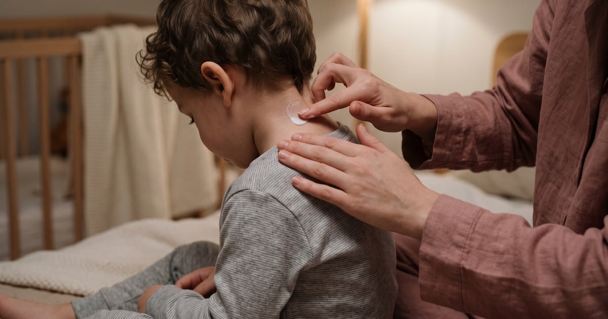 La piel que arde y la billetera que no alcanza: la dermatitis atópica se gana por cansancio al bolsillo argentino